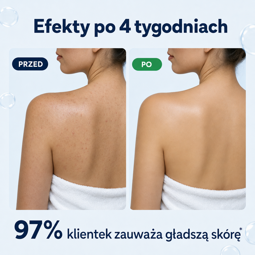 Efekty po 4 tygodniach – przed i po